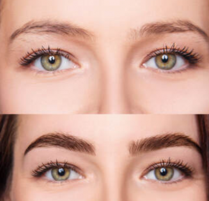 brow-lamination-before-after
